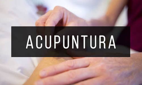 Acupuntura