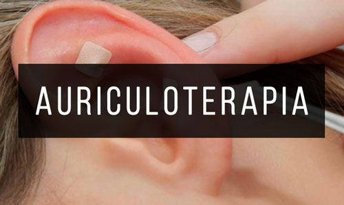 Auriculoterapia Auriculoterapia