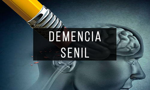 Demencia-Senil Demencia-Senil