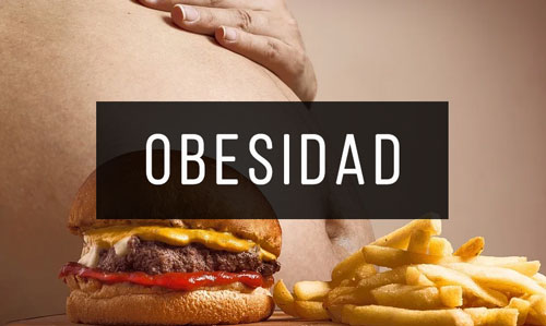 Obesidad Obesidad
