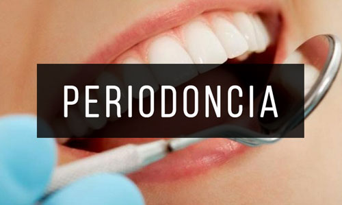 Periodoncia Periodoncia